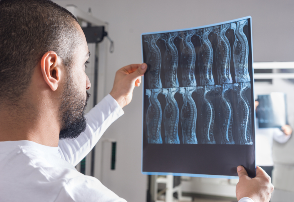 Can You Fully Recover From a Spinal Cord Injury?